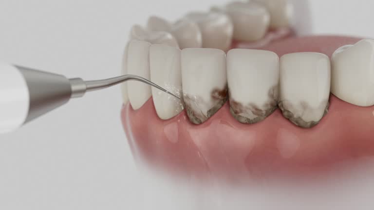 Trusted Wisdom Tooth Removal service in Moscow, PA - Dentist Open Now